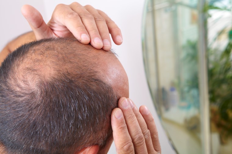 DHT Hair Loss Treatment Sydney | Hair Doctors