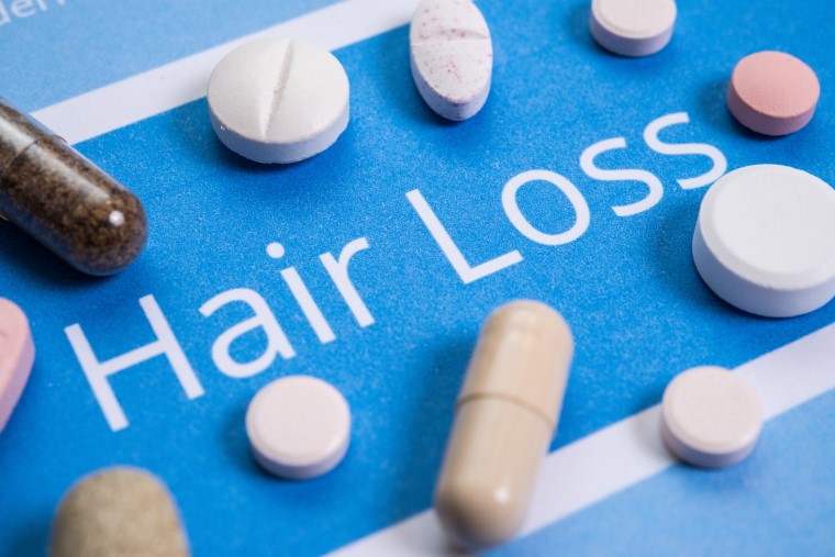sydney hair loss treatment - Hair Doctors