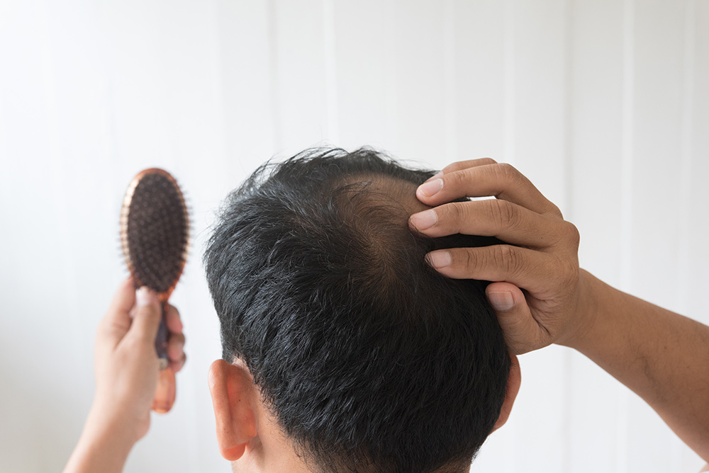how to stop hair from falling out
