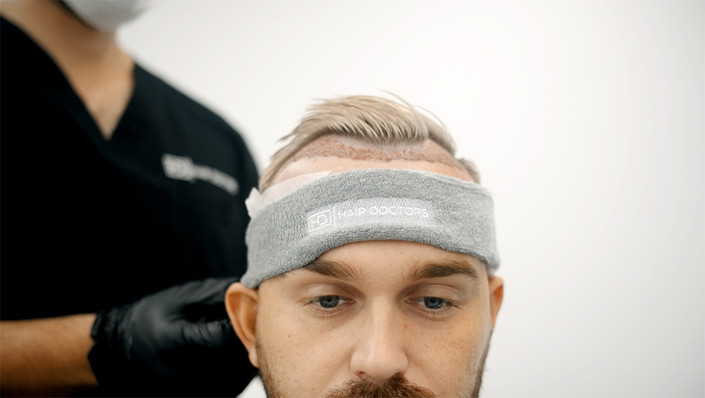 Contact Sports & Strenuous Exercise After Hair Transplant Procedure | Post FUE Hair Transplant Care | Hair Doctors Sydney | Hair Clinic
