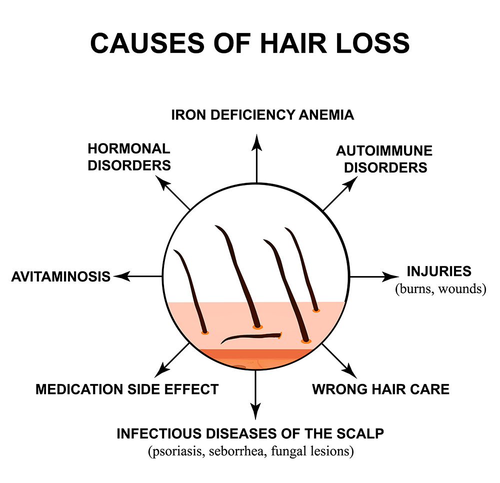 Hair Loss Treatment Melbourne Hair Doctors