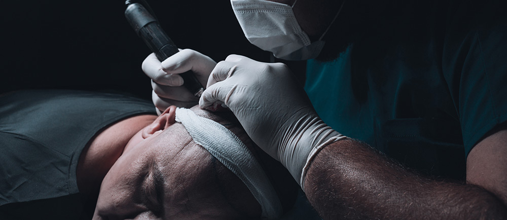 Methods of Hair Transplant Surgery | What is the Most Effective Hair Transplant Method | FUT Hair Transplant | Hair Transplant Clinic | Hair Doctors Australia