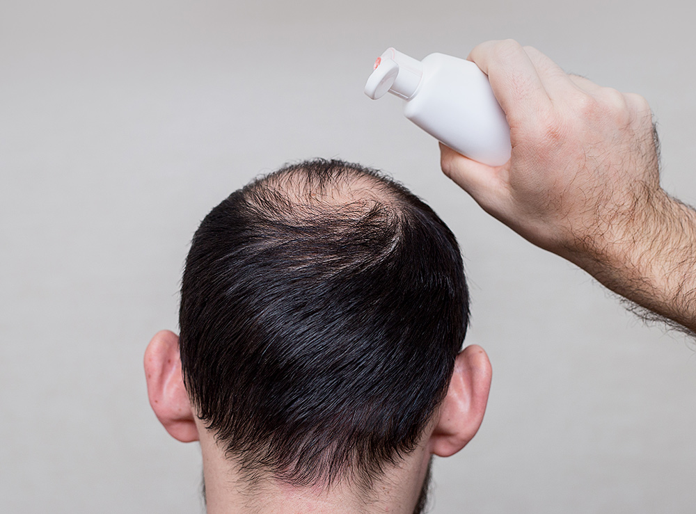 Stop Hair Thinning | Patchy Hair Loss | Male Pattern Hair Loss | Permanent Hair Loss | Hereditary Hair Loss | Hair Restoration Clinic