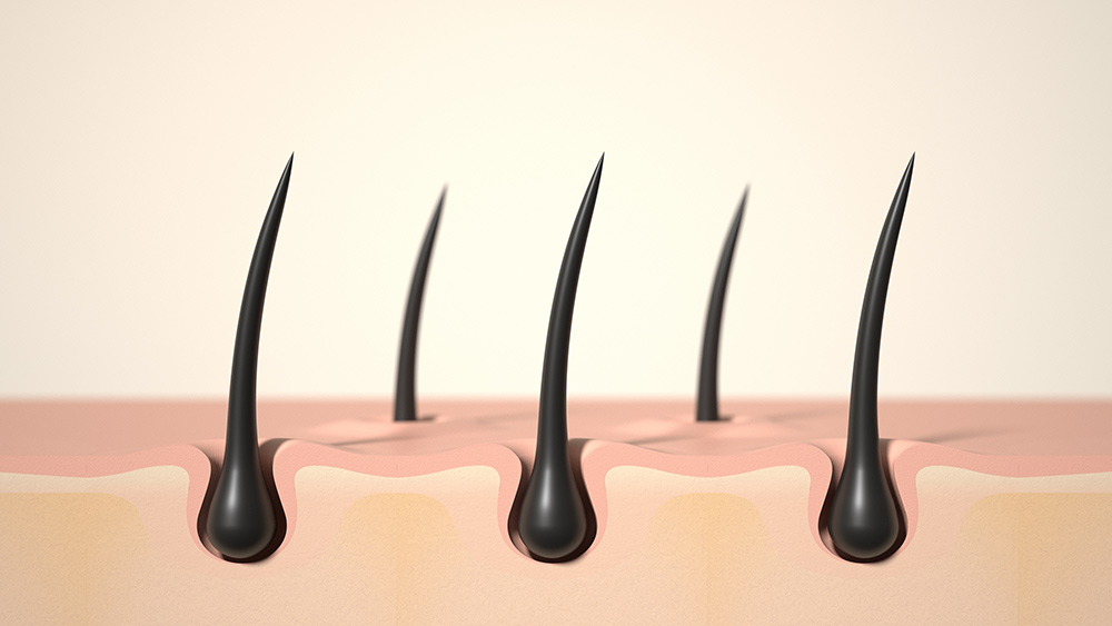Non-Surgical Hair Loss Treatment | Hair Regeneration Protocol at Hair Doctors Sydney & Melbourne | Hair Transplant Clinic