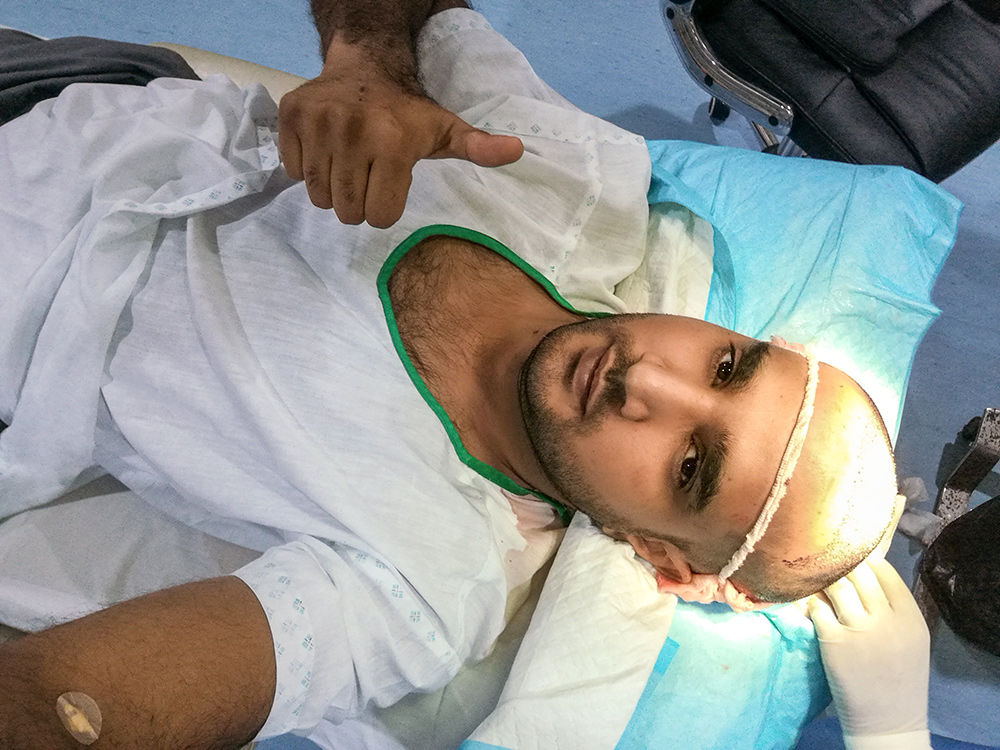 Hair Transplant Procedure For Hair Loss | Do Hair Transplant Results Last | Permanent Hair Growth | Hair Doctors Sydney & Melbourne