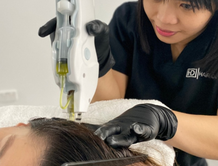 How I Cured My Telogen Effluvium | Hair Growth Treatments | How To Stop Hair Shedding | Medical Hair Loss Solutions | Growth Factor | Exosome Therapy | Scalp Mesotherapy | Hair Doctors Sydney & Melbourne