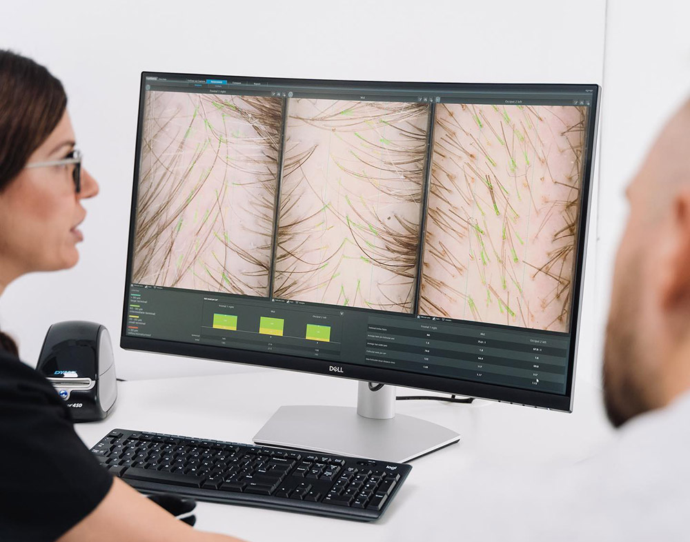 Treatment For Anxiety-Related Hair Shedding | Patchy Or Sudden Hair Loss | Clinical Hair Growth | Hair Doctors Sydney & Melbourne Clinics