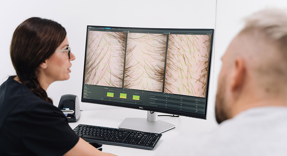 How To Manage FUE Hair Transplant Pain | Local Anaesthetic, Recovery, Aftercare, Pain Management | Hair Doctors | Sydney & Melbourne